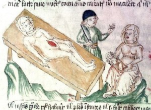 An exceptionally tough mother, or how the world convinced herself about caesarean section 