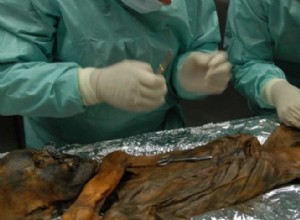 What if Ötzi suffered from an ulcer? 